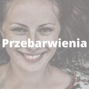 Przebarwienia – jaka jest przyczyna powstania przebarwień skóry i czego należy się wystrzegać?